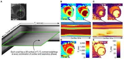 Visualization and Analysis of Multidimensional Cardiovascular Magnetic Resonance Imaging: Challenges and Opportunities